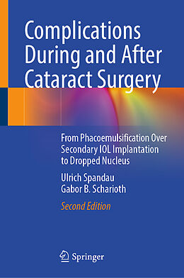 Fester Einband Complications During and After Cataract Surgery von Gabor B. Scharioth, Ulrich Spandau