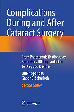 Kartonierter Einband Complications During and After Cataract Surgery von Gabor B. Scharioth, Ulrich Spandau