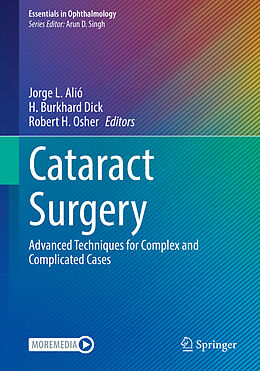 Kartonierter Einband Cataract Surgery von 