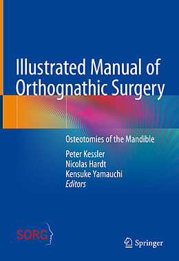 Livre Relié Illustrated Manual of Orthognathic Surgery de 