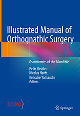 eBook (pdf) Illustrated Manual of Orthognathic Surgery de 