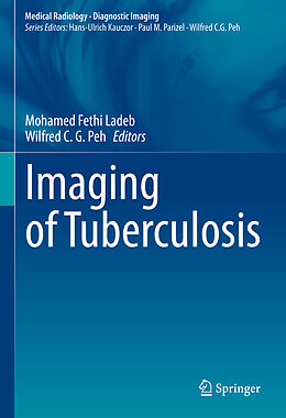 Livre Relié Imaging of Tuberculosis de 