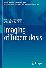 eBook (pdf) Imaging of Tuberculosis de 