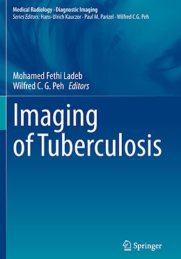 Couverture cartonnée Imaging of Tuberculosis de 