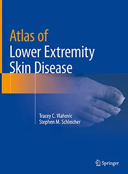 E-Book (pdf) Atlas of Lower Extremity Skin Disease von Tracey C. Vlahovic, Stephen M. Schleicher