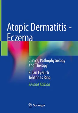 E-Book (pdf) Atopic Dermatitis - Eczema von Kilian Eyerich, Johannes Ring