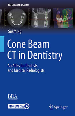 eBook (pdf) Cone Beam CT in Dentistry de Suk Y. Ng