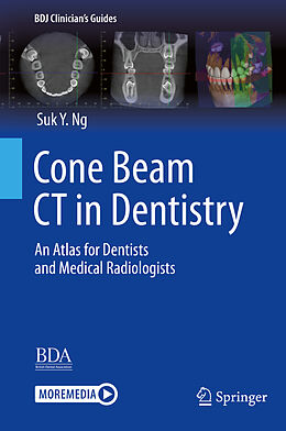 Couverture cartonnée Cone Beam CT in Dentistry de Suk Y. Ng