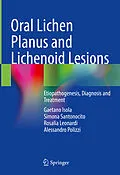 E-Book (pdf) Oral Lichen Planus and Lichenoid Lesions von Gaetano Isola, Simona Santonocito, Rosalia Leonardi