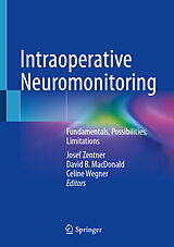 E-Book (pdf) Intraoperative Neuromonitoring von 