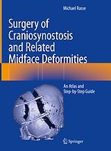 eBook (pdf) Surgery of Craniosynostosis and Related Midface Deformities de Michael Rasse