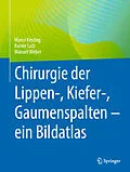 E-Book (pdf) Chirurgie der Lippen-, Kiefer-, Gaumenspalten  ein Bildatlas von Marco Kesting, Rainer Lutz, Manuel Weber