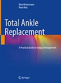 E-Book (pdf) Total Ankle Replacement von Beat Hintermann, Roxa Ruiz
