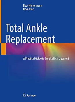 E-Book (pdf) Total Ankle Replacement von Beat Hintermann, Roxa Ruiz
