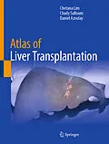 E-Book (pdf) Atlas of Liver Transplantation von Chetana Lim, Chady Salloum, Daniel Azoulay