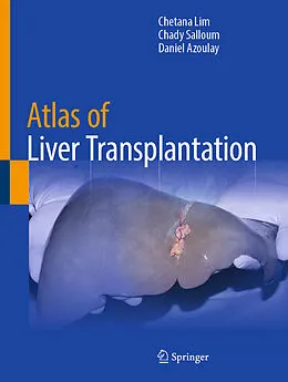 E-Book (pdf) Atlas of Liver Transplantation von Chetana Lim, Chady Salloum, Daniel Azoulay