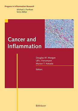Kartonierter Einband Cancer and Inflammation von 