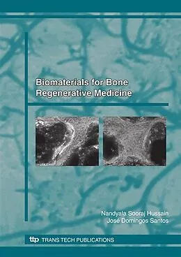 E-Book (pdf) Biomaterials for Bone, Regenerative Medicine von Nandyala Sooraj Hussain, José D. Santos
