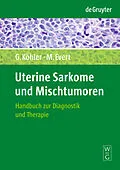 E-Book (pdf) Uterine Sarkome und Mischtumoren von Günter Köhler, Matthias Evert