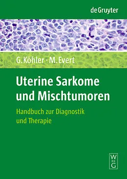 E-Book (pdf) Uterine Sarkome und Mischtumoren von Günter Köhler, Matthias Evert