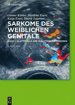 E-Book (epub) Glattmuskuläre und stromale Tumoren von Günter Köhler, Matthias Evert, Katja Evert