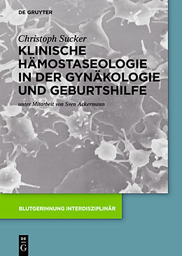 Fester Einband Klinische Hämostaseologie in der Gynäkologie und Geburtshilfe von Christoph Sucker