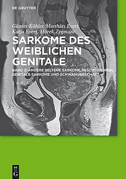 E-Book (epub) Sarkome des weiblichen Genitale / Andere seltene Sarkome, Mischtumoren, genitale Sarkome und Schwangerschaft von Günter Köhler, Matthias Evert, Katja Evert