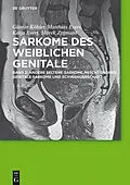 E-Book (pdf) Andere seltene Sarkome, Mischtumoren, genitale Sarkome und Schwangerschaft von Günter Köhler, Matthias Evert, Katja Evert