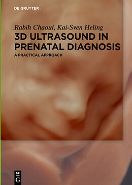 eBook (epub) 3D Ultrasound in Prenatal Diagnosis de Rabih Chaoui, Kai-Sven Heling