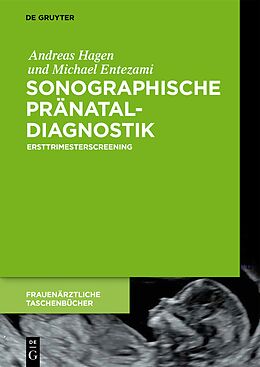 Fester Einband Sonographische Pränataldiagnostik von Andreas Hagen, Michael Entezami