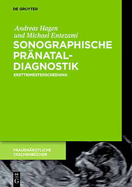 E-Book (epub) Sonographische Pränataldiagnostik von Andreas Hagen, Michael Entezami