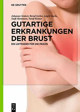 E-Book (epub) Gutartige Erkrankungen der Brust von Johannes Stubert, Bernd Gerber, Angrit Stachs