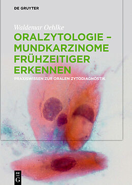 E-Book (pdf) Oralzytologie - Mundkarzinome frühzeitiger erkennen von Waldemar Oehlke