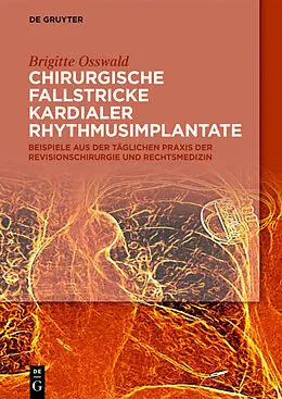 E-Book (pdf) Chirurgische Fallstricke kardialer Rhythmusimplantate von Brigitte Osswald