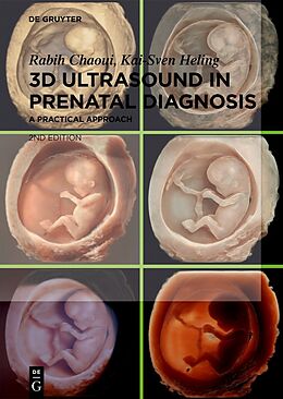 eBook (pdf) 3D Ultrasound in Prenatal Diagnosis de Rabih Chaoui, Kai-Sven Heling