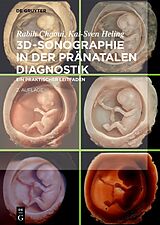 E-Book (epub) 3D-Sonographie in der pränatalen Diagnostik von Rabih Chaoui, Kai-Sven Heling