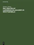 E-Book (pdf) Die zentrale Lungenschlagader im Röntgenbild von Karlheinz Richter