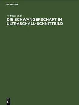 E-Book (pdf) Die Schwangerschaft im Ultraschall-Schnittbild von H. Bayer, R. Schulte, P. Prenzlau