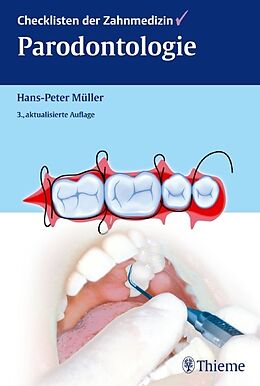 Fester Einband Checklisten der Zahnmedizin Parodontologie von Hans-Peter Müller