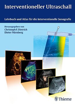 Fester Einband Interventioneller Ultraschall von Christoph Frank Dietrich, Dieter Nürnberg