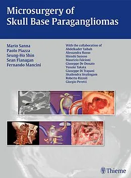 E-Book (pdf) Microsurgery of Skull Base Paragangliomas von Paolo Piazza, Seung-Ho Shin, Sean Flanagan