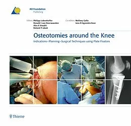 E-Book (pdf) Osteotomies around the Knee von Philipp Lobenhoffer, Ronald J. van Heerwaarden, Alex E. Staubli