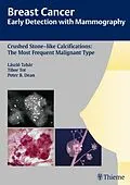 E-Book (pdf) Breast Cancer: Early Detection with Mammography von Laszlo Tabar, Tibor Tot, Peter B. Dean