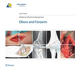 E-Book (pdf) AO Manual of Fracture Management - Elbow and Forearm von Jesse Jupiter