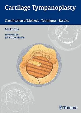 E-Book (pdf) Cartilage Tympanoplasty von Mirko Tos