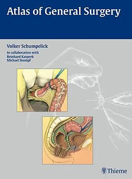E-Book (pdf) Atlas of General Surgery von Volker Schumpelick