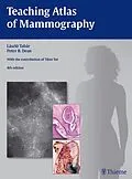 E-Book (pdf) Teaching Atlas of Mammography von Peter B. Dean, Laszlo Tabar