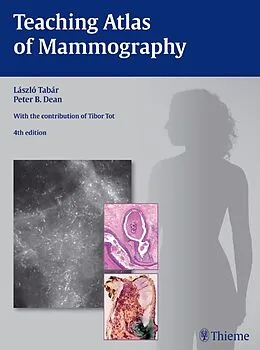 E-Book (pdf) Teaching Atlas of Mammography von Peter B. Dean, Laszlo Tabar