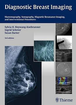 E-Book (pdf) Diagnostic Breast Imaging von Sylvia H. Heywang-Köbrunner, Ingrid Schreer, Susan Barter