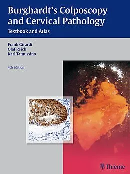 E-Book (pdf) Burghardt's Colposcopy and Cervical Pathology von Erich Burghardt, Frank Girardi, Olaf Reich